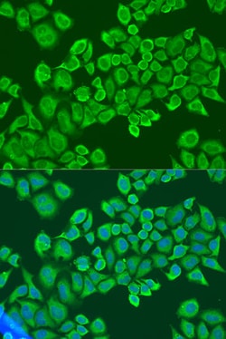 Invitrogen IGF2BP2 Polyclonal Antibody 100 &mu;L; Unconjugated:Antibodies,