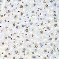 Invitrogen IGF2BP2 Polyclonal Antibody 100 &mu;L; Unconjugated:Antibodies,