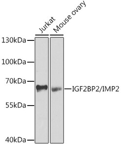 Invitrogen IGF2BP2 Polyclonal Antibody 100 &mu;L; Unconjugated:Antibodies,