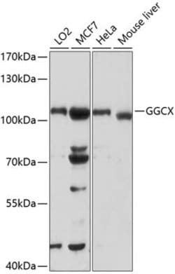 Invitrogen GGCX Polyclonal Antibody 100 &mu;L; Unconjugated:Antibodies,
