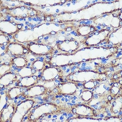 Invitrogen SND1 Polyclonal Antibody 100 &mu;L; Unconjugated:Antibodies,