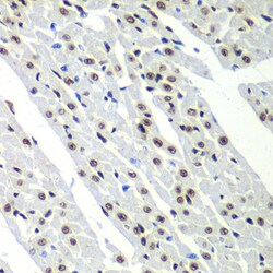 Invitrogen SF3B2 Polyclonal Antibody 100 &mu;L | Buy Online | Invitrogen&trade; | Fisher Scientific