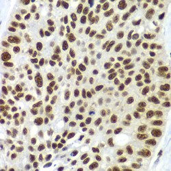 Invitrogen SF3B2 Polyclonal Antibody 100 &mu;L | Buy Online | Invitrogen&trade; | Fisher Scientific
