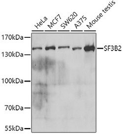 Invitrogen SF3B2 Polyclonal Antibody 100 &mu;L | Buy Online | Invitrogen&trade; | Fisher Scientific