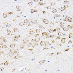 Invitrogen RPL4 Polyclonal Antibody 100 μL; Unconjugated:Antibodies,
