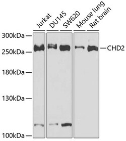 Invitrogen CHD2 Polyclonal Antibody 100 &mu;L; Unconjugated:Antibodies,