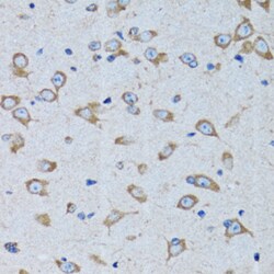 Invitrogen RARS Polyclonal Antibody 100 &mu;L; Unconjugated:Antibodies,