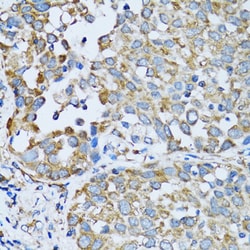 Invitrogen RARS Polyclonal Antibody 100 &mu;L; Unconjugated:Antibodies,