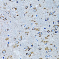 Invitrogen RARS Polyclonal Antibody 100 &mu;L; Unconjugated:Antibodies,
