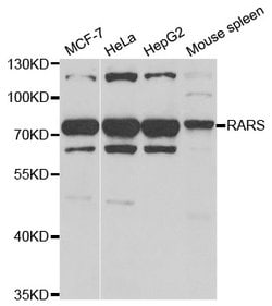 Invitrogen RARS Polyclonal Antibody 100 &mu;L; Unconjugated:Antibodies,