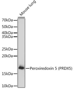 Invitrogen PRDX5 Polyclonal Antibody 100 &mu;L; Unconjugated:Antibodies,