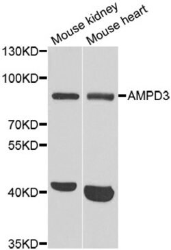 Invitrogen AMPD3 Polyclonal Antibody 100 &mu;L; Unconjugated:Antibodies,