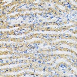 Invitrogen C4BPB Polyclonal Antibody 100 &mu;L; Unconjugated:Antibodies,
