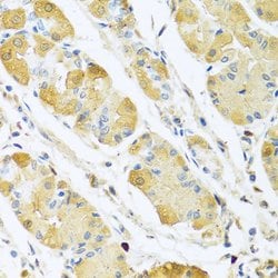 Invitrogen C4BPB Polyclonal Antibody 100 &mu;L; Unconjugated:Antibodies,