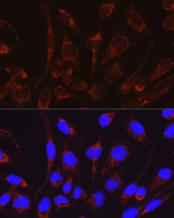 Invitrogen CAT1 Polyclonal Antibody 100 &mu;L; Unconjugated:Antibodies,