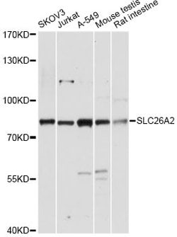 Invitrogen SLC26A2 Polyclonal Antibody 100 &mu;L; Unconjugated:Antibodies,