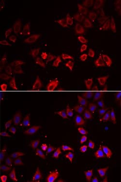 Invitrogen LIMS1 Polyclonal Antibody 100 &mu;L; Unconjugated:Antibodies,