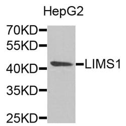 Invitrogen LIMS1 Polyclonal Antibody 100 &mu;L; Unconjugated:Antibodies,
