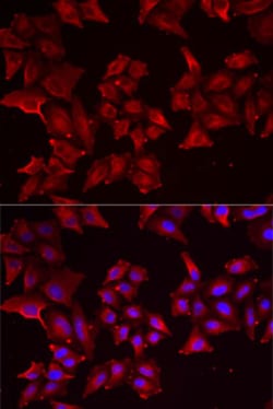 Invitrogen PCBD1 Polyclonal Antibody 100 &mu;L; Unconjugated:Antibodies,