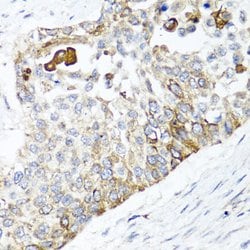 Invitrogen PPOX Polyclonal Antibody 100 &mu;L; Unconjugated:Antibodies,