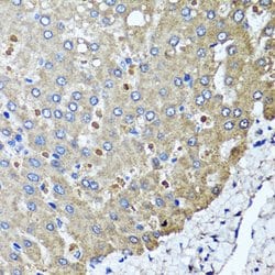 Invitrogen PPOX Polyclonal Antibody 100 &mu;L; Unconjugated:Antibodies,