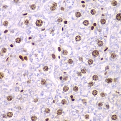 Invitrogen SSRP1 Polyclonal Antibody 100 &mu;L; Unconjugated:Antibodies,