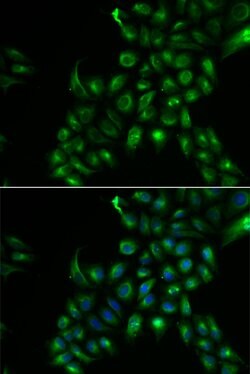 Invitrogen TSPAN7 Polyclonal Antibody 100 &mu;L | Buy Online | Invitrogen&trade; | Fisher Scientific