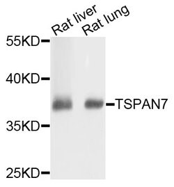 Invitrogen TSPAN7 Polyclonal Antibody 100 &mu;L | Buy Online | Invitrogen&trade; | Fisher Scientific