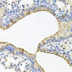 Invitrogen SKAP2 Polyclonal Antibody 100 &mu;L; Unconjugated:Antibodies,
