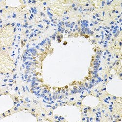 Invitrogen SKAP2 Polyclonal Antibody 100 &mu;L; Unconjugated:Antibodies,