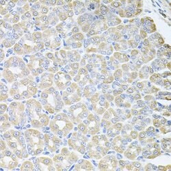 Invitrogen SKAP2 Polyclonal Antibody 100 &mu;L; Unconjugated:Antibodies,