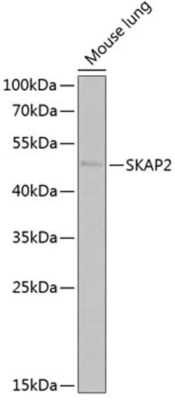 Invitrogen SKAP2 Polyclonal Antibody 100 &mu;L; Unconjugated:Antibodies,