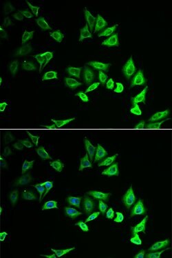 Invitrogen MYOZ2 Polyclonal Antibody 100 &mu;L; Unconjugated:Antibodies,