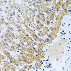 Invitrogen CPA6 Polyclonal Antibody 100 &mu;L; Unconjugated:Antibodies,