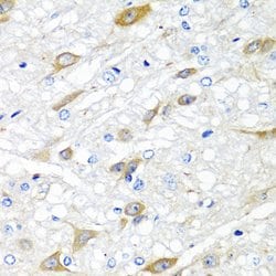 Invitrogen CPA6 Polyclonal Antibody 100 &mu;L; Unconjugated:Antibodies,