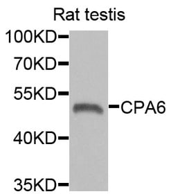Invitrogen CPA6 Polyclonal Antibody 100 &mu;L; Unconjugated:Antibodies,