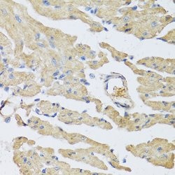 UCN2 Polyclonal Antibody 100 &mu;L | Buy Online | Thermo Scientific | Fisher Scientific
