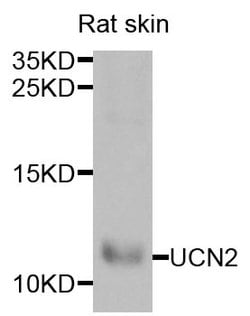 UCN2 Polyclonal Antibody 100 &mu;L | Buy Online | Thermo Scientific | Fisher Scientific