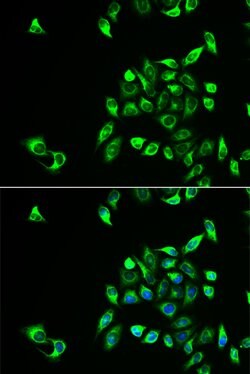 Invitrogen CSNK1A1L Polyclonal Antibody 100 &mu;L | Buy Online | Invitrogen&trade; | Fisher Scientific