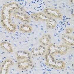 Invitrogen HPS1 Polyclonal Antibody 100 &mu;L; Unconjugated:Antibodies,