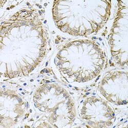 Invitrogen HPS1 Polyclonal Antibody 100 &mu;L; Unconjugated:Antibodies,
