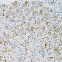 Invitrogen HPS1 Polyclonal Antibody 100 &mu;L; Unconjugated:Antibodies,