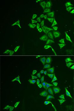 Invitrogen INPP5J Polyclonal Antibody 100 &mu;L; Unconjugated:Antibodies,