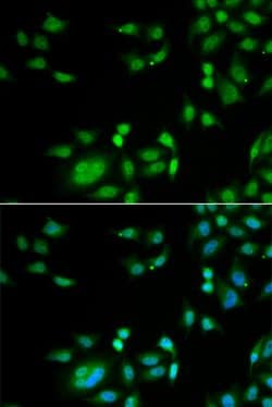 Invitrogen INTS10 Polyclonal Antibody 100 &mu;L; Unconjugated:Antibodies,