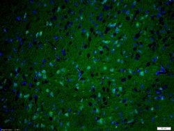 Invitrogen KIF1B Polyclonal Antibody 100 &mu;L; Unconjugated:Antibodies,