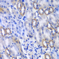Invitrogen MATK Polyclonal Antibody 100 &mu;L; Unconjugated:Antibodies,