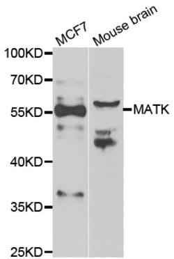 Invitrogen MATK Polyclonal Antibody 100 &mu;L; Unconjugated:Antibodies,