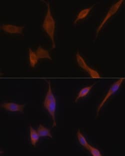 Invitrogen Melanophilin Polyclonal Antibody 100 &mu;L; Unconjugated:Antibodies,