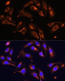 Invitrogen Melanophilin Polyclonal Antibody 100 &mu;L; Unconjugated:Antibodies,