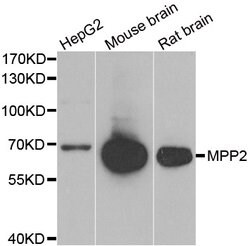 Invitrogen MPP2 Polyclonal Antibody 100 &mu;L; Unconjugated:Antibodies,